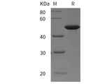 SDS-PAGE analysis of Human FGFR3 proteins, 2 μg/lane of Recombinant Human FGFR3 proteins was resolved with SDS-PAGE under reducing conditions, showing bands at 45 kDa.