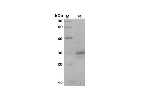 SDS-PAGE analysis of Monkey CT proteins, 2 μg/lane of Recombinant Monkey CT proteins was resolved with SDS-PAGE under reducing conditions, showing bands at 30 kDa.