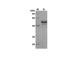 Recombinant Human TH TYH Protein(Sumo Tag) - ABMIUM
