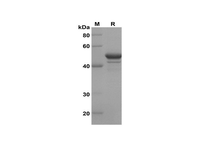 Recombinant Human TH TYH Protein(Sumo Tag) - ABMIUM