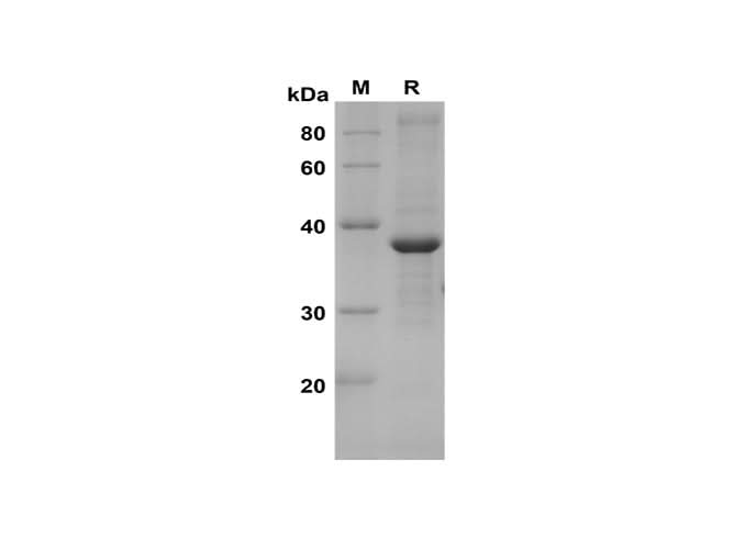 SDS-PAGE analysis of Human CASP9 proteins, 2 μg/lane of Recombinant Human CASP9 proteins was resolved with SDS-PAGE under reducing conditions, showing bands at 37 kDa.