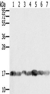 Anti-Human/Mouse/Rat PPIA Antibody - ABMIUM