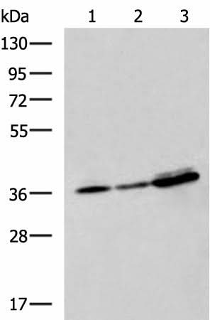 Western blot analysis of A549 A172 and HepG2 cell lysates using EEF1D Polyclonal Antibody at dilution of 1:950