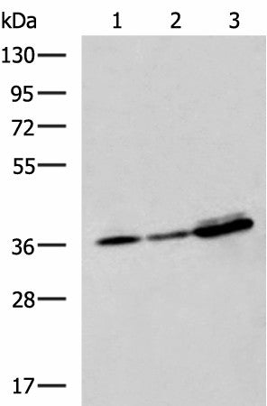 Western blot analysis of A549 A172 and HepG2 cell lysates using EEF1D Polyclonal Antibody at dilution of 1:950