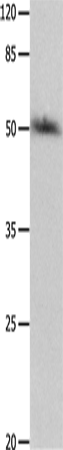 Anti-Human P2RY2 Antibody - ABMIUM
