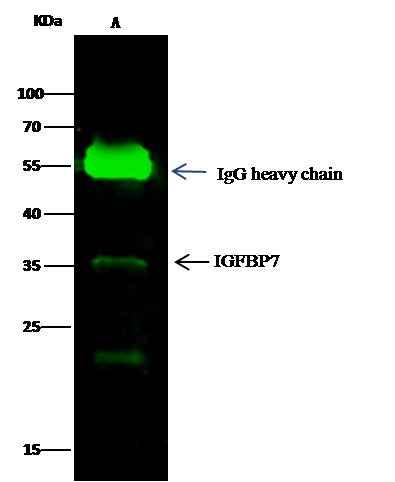 Anti-Human IGFBP7 Antibody [A1174] - ABMIUM