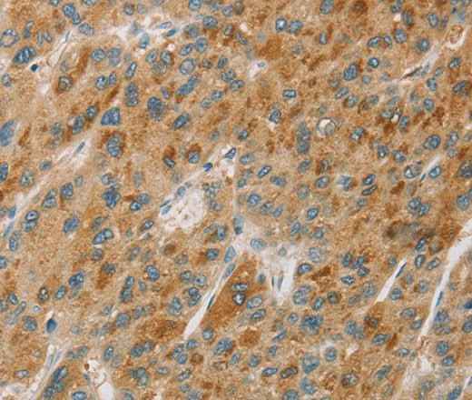 Anti-Human CYP11B1 Antibody