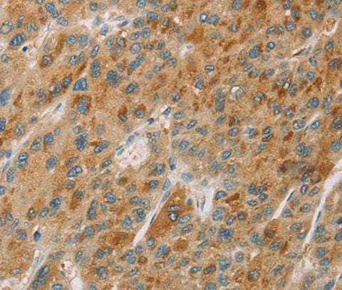 Anti-Human CYP11B1 Antibody - ABMIUM