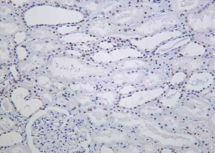 Anti-Human/Mouse/Rat ARID1A Antibody [B1024] - ABMIUM