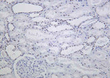 Anti-Human/Mouse/Rat ARID1A Antibody [B1024]
