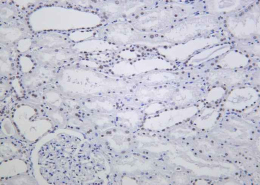 Anti-Human/Mouse/Rat ARID1A Antibody [B1024] - ABMIUM