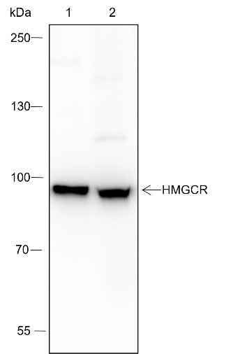 Anti-Human/Mouse HMGCR Antibody [A254] - ABMIUM