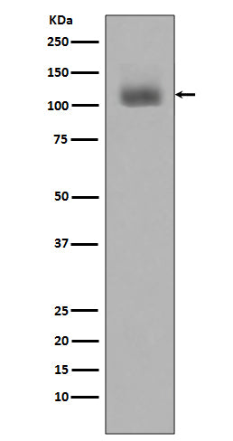Anti-Phospho-JAK2 (Y1007 + Y1008) Monoclonal Antibody Boster Bio