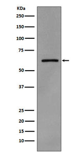 Anti-Phospho-Src (Y419) Monoclonal Antibody Boster Bio