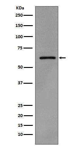 Anti-Phospho-Src (Y419) Monoclonal Antibody Boster Bio