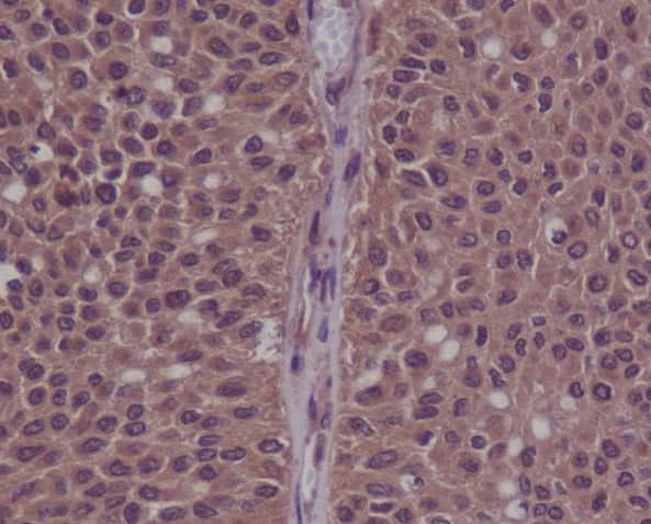 Anti-Phospho-CDK2 (Y15) Rabbit Monoclonal Antibody Boster Bio