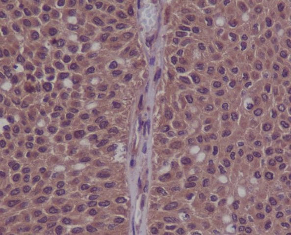 Anti-Phospho-CDK2 (Y15) Rabbit Monoclonal Antibody Boster Bio