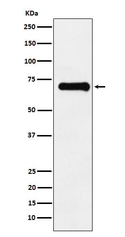 Anti-Phospho-PAK4 + PAK5 + PAK6 (S474 + S560 + S602) Monoclonal Antibody Boster Bio