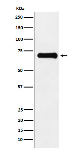 Anti-Phospho-PAK4 + PAK5 + PAK6 (S474 + S560 + S602) Monoclonal Antibody Boster Bio