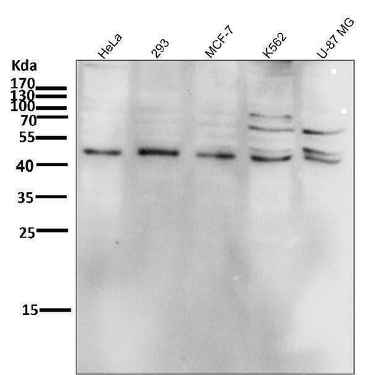 Anti-Phospho-JNK1/2/3 (T183+T183+T221) MAPK8 Monoclonal Antibody Boster Bio