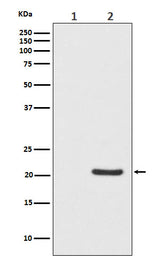 Anti-Phospho-Bad (S112) Monoclonal Antibody Boster Bio