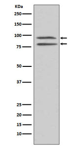 Anti-Phospho-MSK1 (S376) RPS6KA5 Monoclonal Antibody Boster Bio