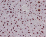 Anti-Phospho-Histone H3 (S10) HIST1H3A Rabbit Monoclonal Antibody Boster Bio