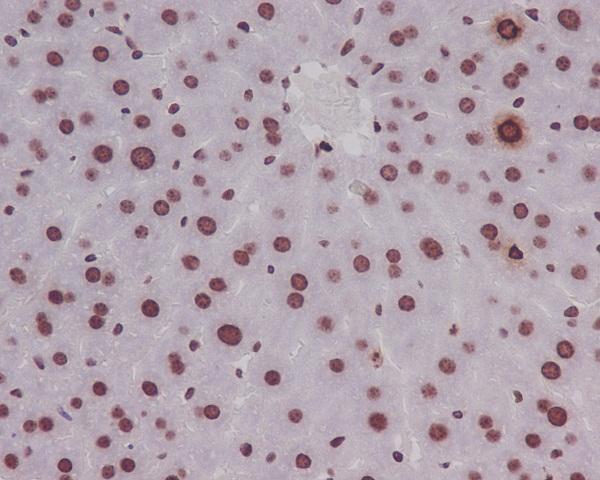 Anti-Phospho-Histone H3 (S10) HIST1H3A Rabbit Monoclonal Antibody Boster Bio