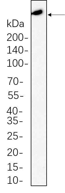 Anti-Human/Mouse/Rat Atm Antibody [B548] - ABMIUM