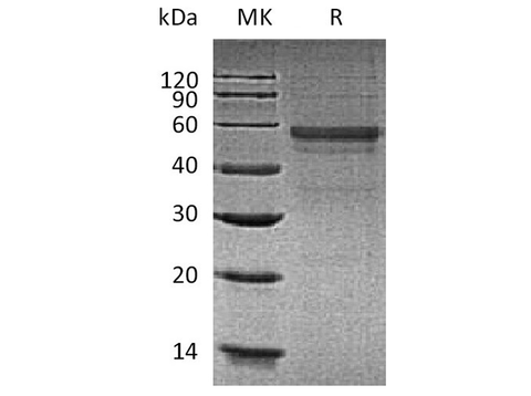 Recombinant Human GLP1R Protein (Fc Tag) - ABMIUM
