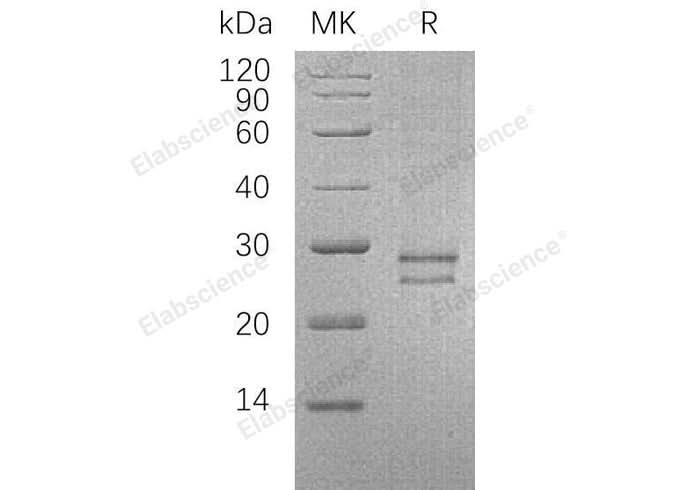 Recombinant Human CRISP3/SGP28 Protein (His Tag) - ABMIUM