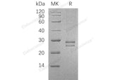 Recombinant Human CRISP3/SGP28 Protein (His Tag) - ABMIUM