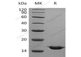 Recombinant Human Cystatin SA/CST2 Protein (His Tag) - ABMIUM