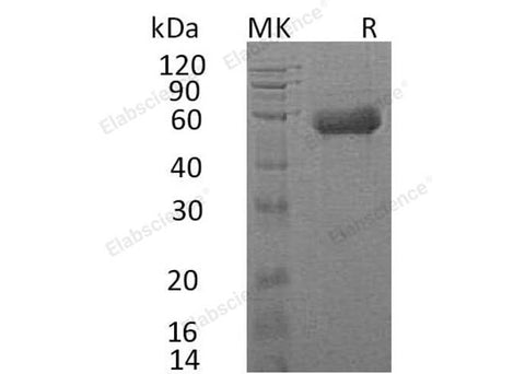 Recombinant Human IL18RAP/IL1R7 Protein (His Tag) - ABMIUM