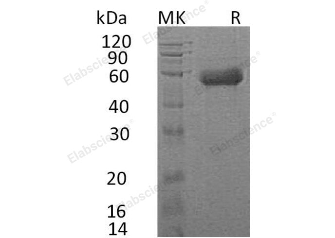 Recombinant Human IL18RAP/IL1R7 Protein (His Tag) - ABMIUM