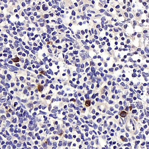 Immunohistochemistry analysis of paraffin-embedded rat lymph node using BAG2 Polyclonal Antibody at dilution of 1:400.