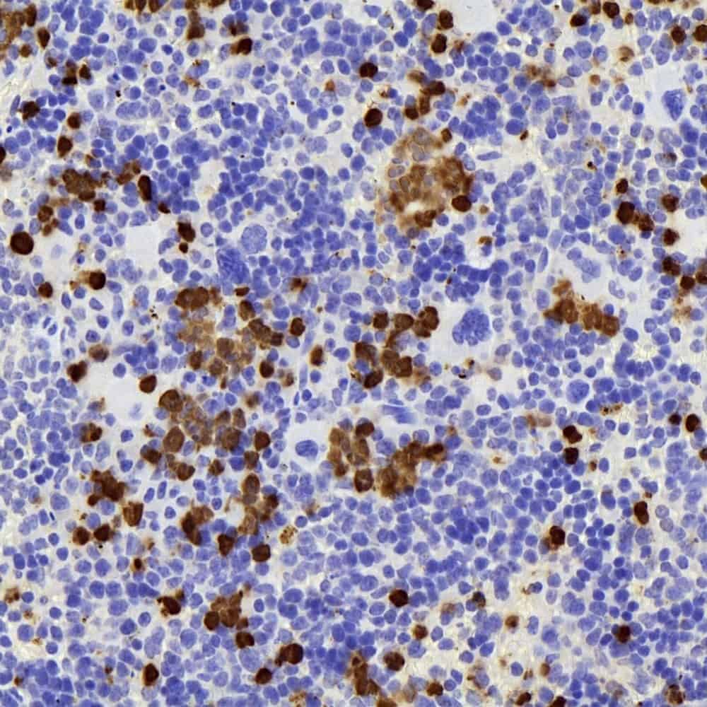 Immunohistochemistry analysis of paraffin-embedded mouse Immunized spleen using S100A8 Polyclonal Antibody at dilution of 1:400.