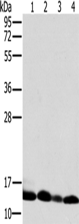 Anti-Human NDUFS5 Antibody - ABMIUM
