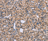 Anti-Human ADAM29 Antibody - ABMIUM