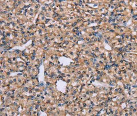 Anti-Human ADAM29 Antibody