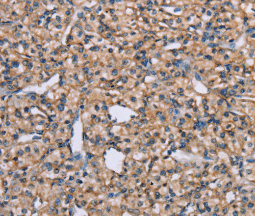 Anti-Human ADAM29 Antibody - ABMIUM