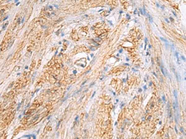 Anti-Human/Mouse TMOD3 Antibody