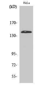 Western Blot analysis of Hela cells using PERK Polyclonal Antibody at dilution of 1:2000.