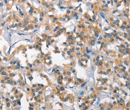 Anti-Human SCARB1 Antibody