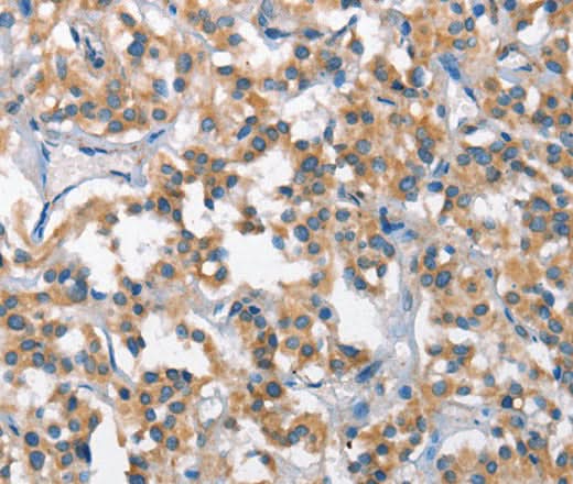 Anti-Human SCARB1 Antibody - ABMIUM