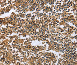 Anti-Human/Mouse/Rat ECE1 Antibody - ABMIUM