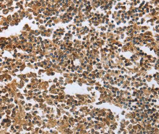 Anti-Human/Mouse/Rat ECE1 Antibody