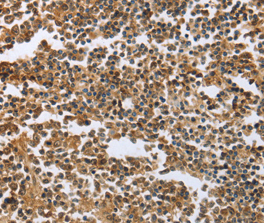 Anti-Human/Mouse/Rat ECE1 Antibody - ABMIUM