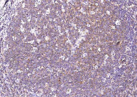 Anti-Human SLAMF1 Antibody [B272] - ABMIUM