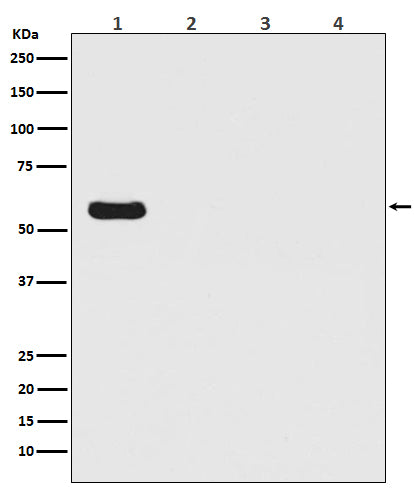 Anti-Firefly Luciferase Rabbit Monoclonal Antibody Boster Bio